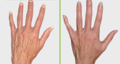 Comparison before and after treatment