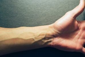 hand