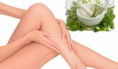 Treatment of varicose veins of the lower limbs with folk remedies