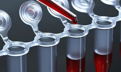 blood test for varicose veins of the legs