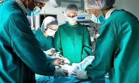 surgery for varicose veins of the legs