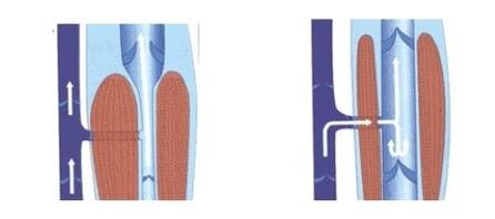 the proper functioning of the venous pump