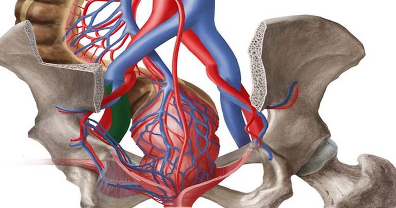 Varicose veins of the small pelvis